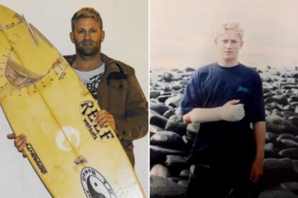 South African surfer attacked by two great white sharks paddled to safety with one hand: ‘Thought I was going to die’