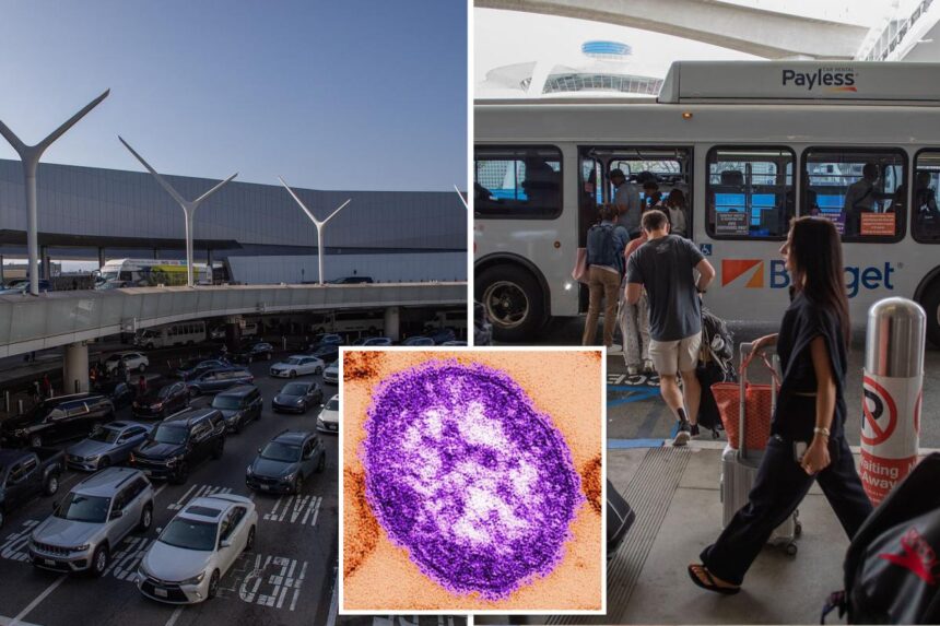 Measles case reported at LAX as global World Cup travel sparks fears of spread