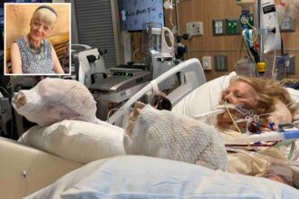 82-year-old mother suffers severe burns ‘down to the muscle and the bone’ after falling asleep by pool