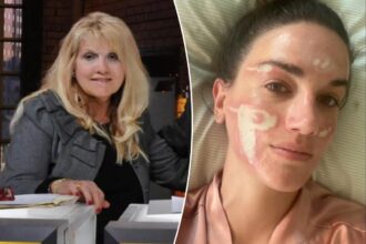 Celebrity esthetician loses her license after client says she was left ‘permanently scarred’