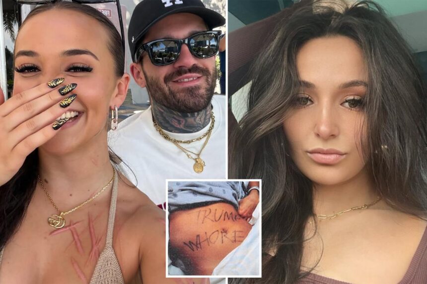 Ex-NJ GOP aide accused of staging slashing attack shows off horrific scars — and mystery man — in new snap