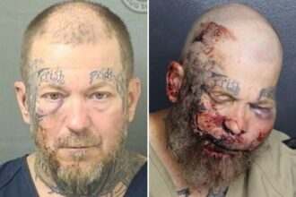 Florida man left with swollen face in mugshot after attacking cop inside hospital: ‘I want to fight you’