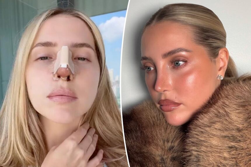 Why this beauty influencer tried to hide her ,000 Beverly Hills nose job