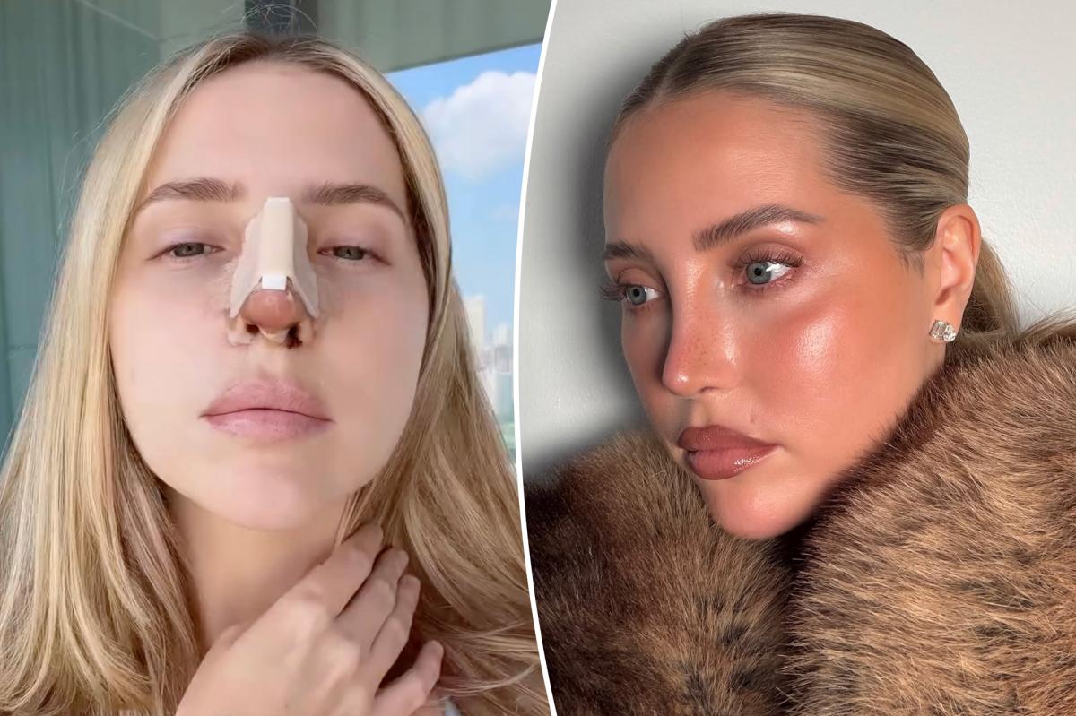 Why this beauty influencer tried to hide her ,000 Beverly Hills nose job