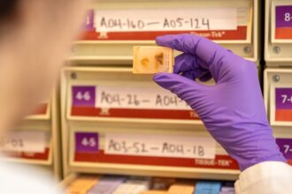 Fetal tissue supplier billed 5 procurement fee per organ, warn paperwork could imply illegal sales: records