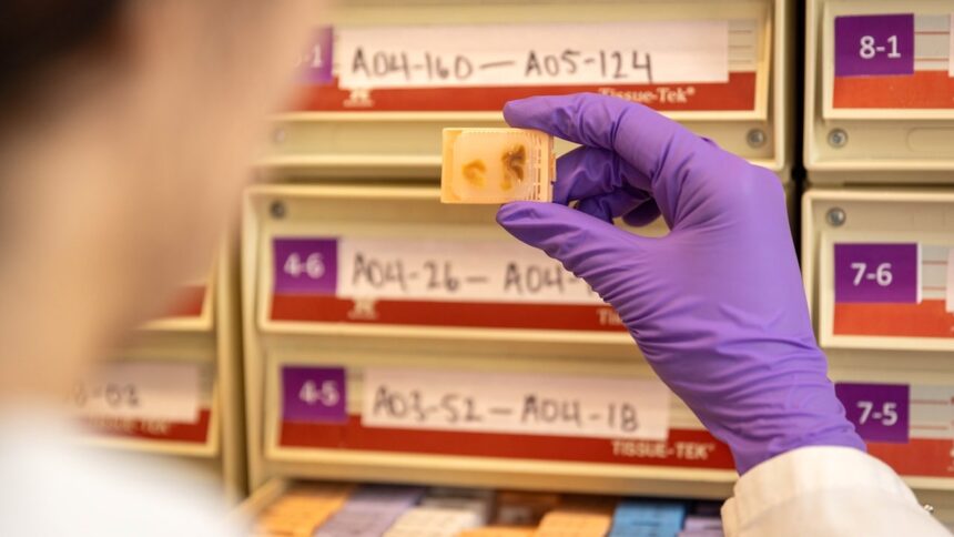 Fetal tissue supplier billed 5 procurement fee per organ, warn paperwork could imply illegal sales: records