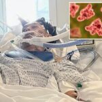 North Carolina teen dies from rare brain-eating amoeba typically linked to freshwater swimming