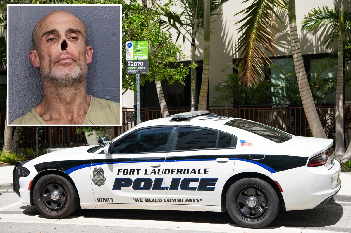 Noseless NYC man arrested on meth and cocaine charges in Florida: cops
