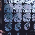 This family’s heartbreaking struggle with dementia in midlife may upend our understanding of the disease — and hope for a cure