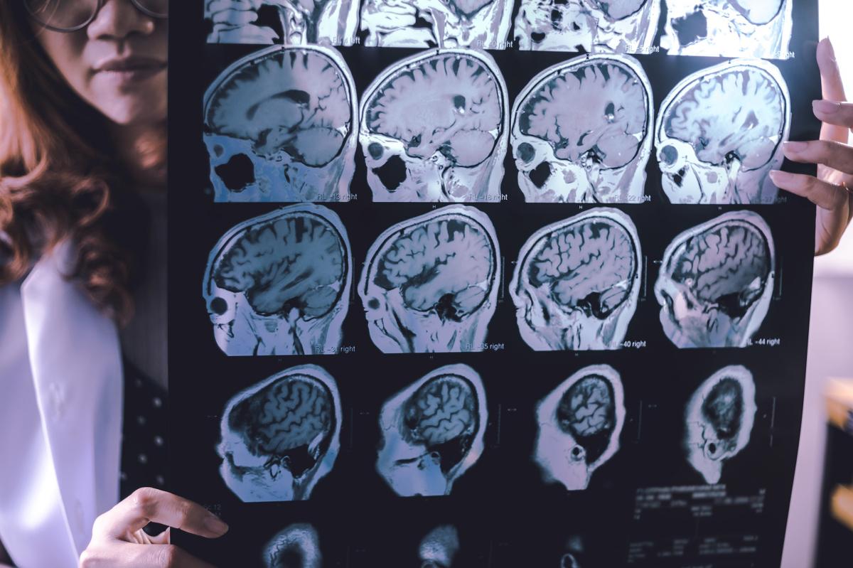 This family’s heartbreaking struggle with dementia in midlife may upend our understanding of the disease — and hope for a cure